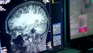 Badania tysięcy skanów MRI wykazały, że zaburzenia psychiczne nastolatków wiążą się z zaburzeniami fali dojrzewania kory mózgowej (zdj. ilustr.)