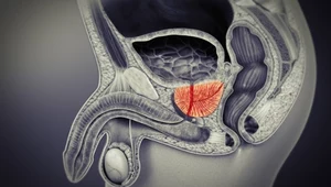 Ultradźwięki z aż 80% skutecznością pomagają już w leczeniu raka prostaty