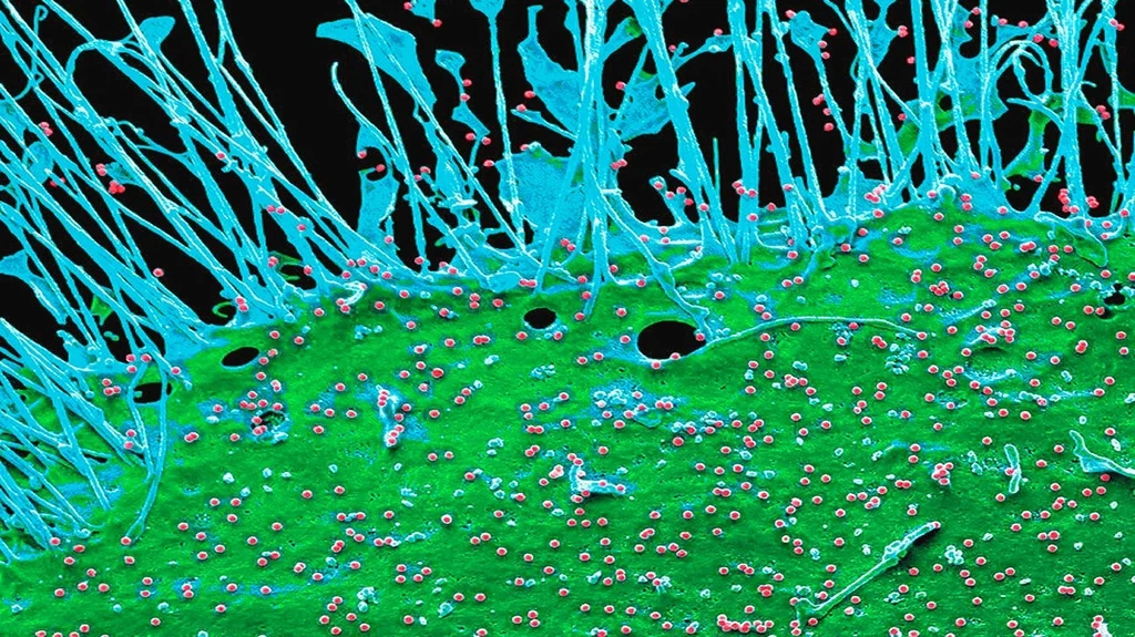 Tak niesamowicie wygląda na filmie rozprzestrzenianie się wirusa HIV [FILM]