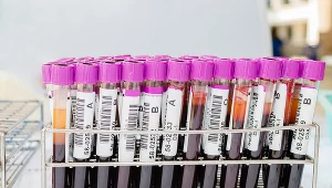 Morfologia to podstawowe badanie, od którego najczęściej zaczyna się diagnostyka