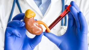 To dlatego sprawdza się poziom kreatyniny w organizmie