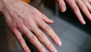 Wątroba nie jest unerwiona, w przeciwieństwie od większości narządów nie zaboli, gdy zachoruje