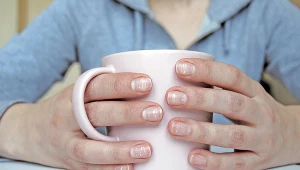 Zmiany na ustach, języku, paznokciach czy włosach? Organizm wysyła sygnał