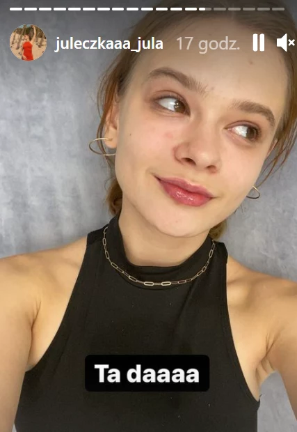 Julia Wróblewska pokazała efekt powiększania ust. Źródło: Instagram/ juleczkaaa_jula