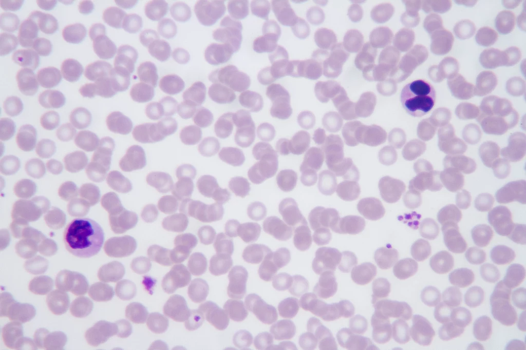 Sporozoity Plasmodium vivax