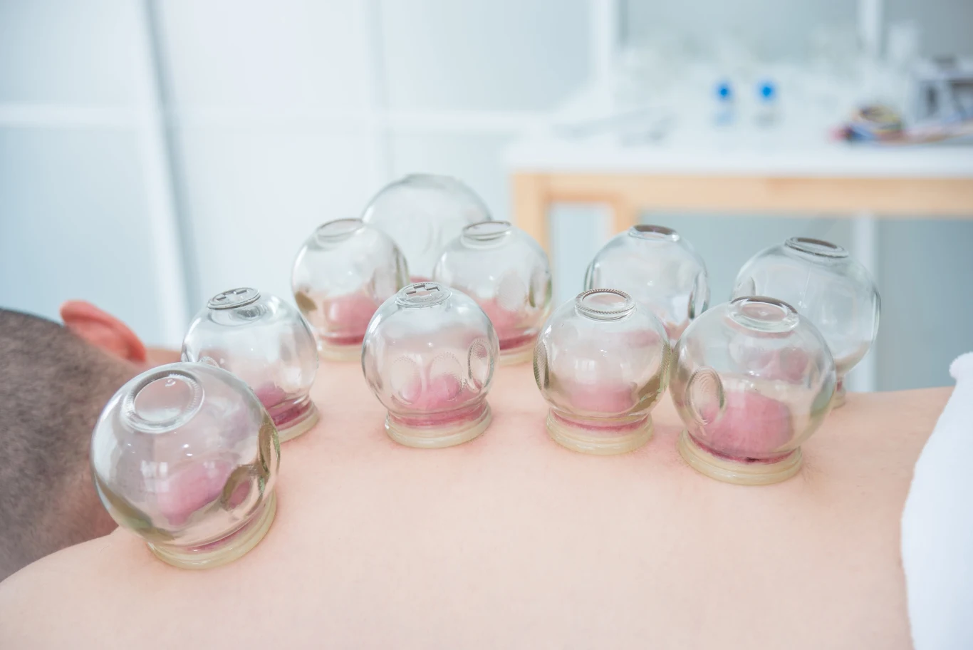 Chcesz zastosować u siebie bańki? Skonsultuj się najpierw z lekarzem