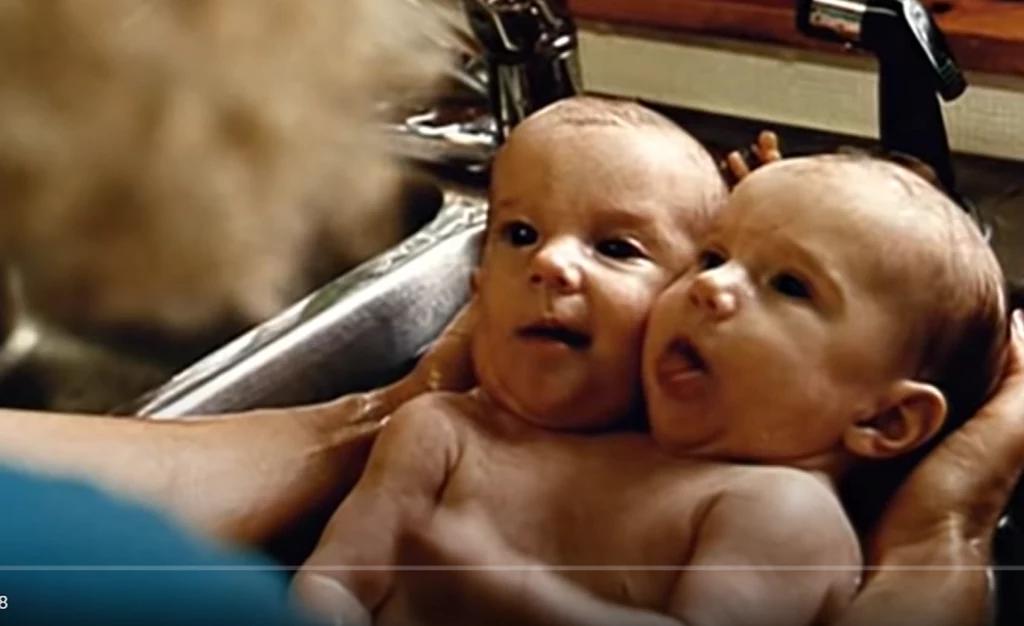 Życie bliźniaczek syjamskich zostało pokazane w filmach dokumentalnych, w których zdecydowały się wziąć udział
