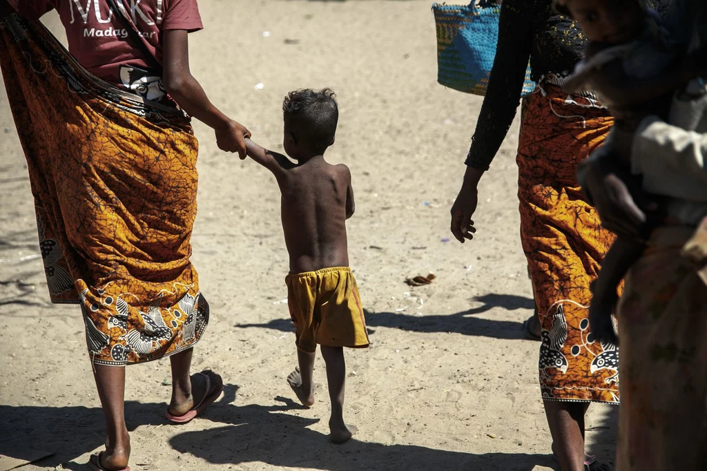 Na Madagaskarze już teraz panuje klęska głosu, jakiej nie było tam od dziesięcioleci Na Madagaskarze już teraz panuje klęska głosu, jakiej nie było tam od dziesięcioleci