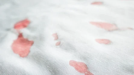 ​Plamy z morwy są nie do sprania? Nie tym razem. Tak usuniesz je bez problemu