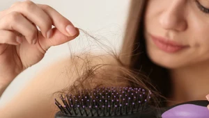 Jak ograniczyć wypadanie włosów? Cztery proste domowe sposoby