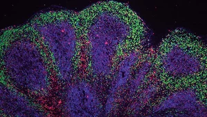 Organoidy mózgowe przetrwały w laboratorium rekordowe 240 dni