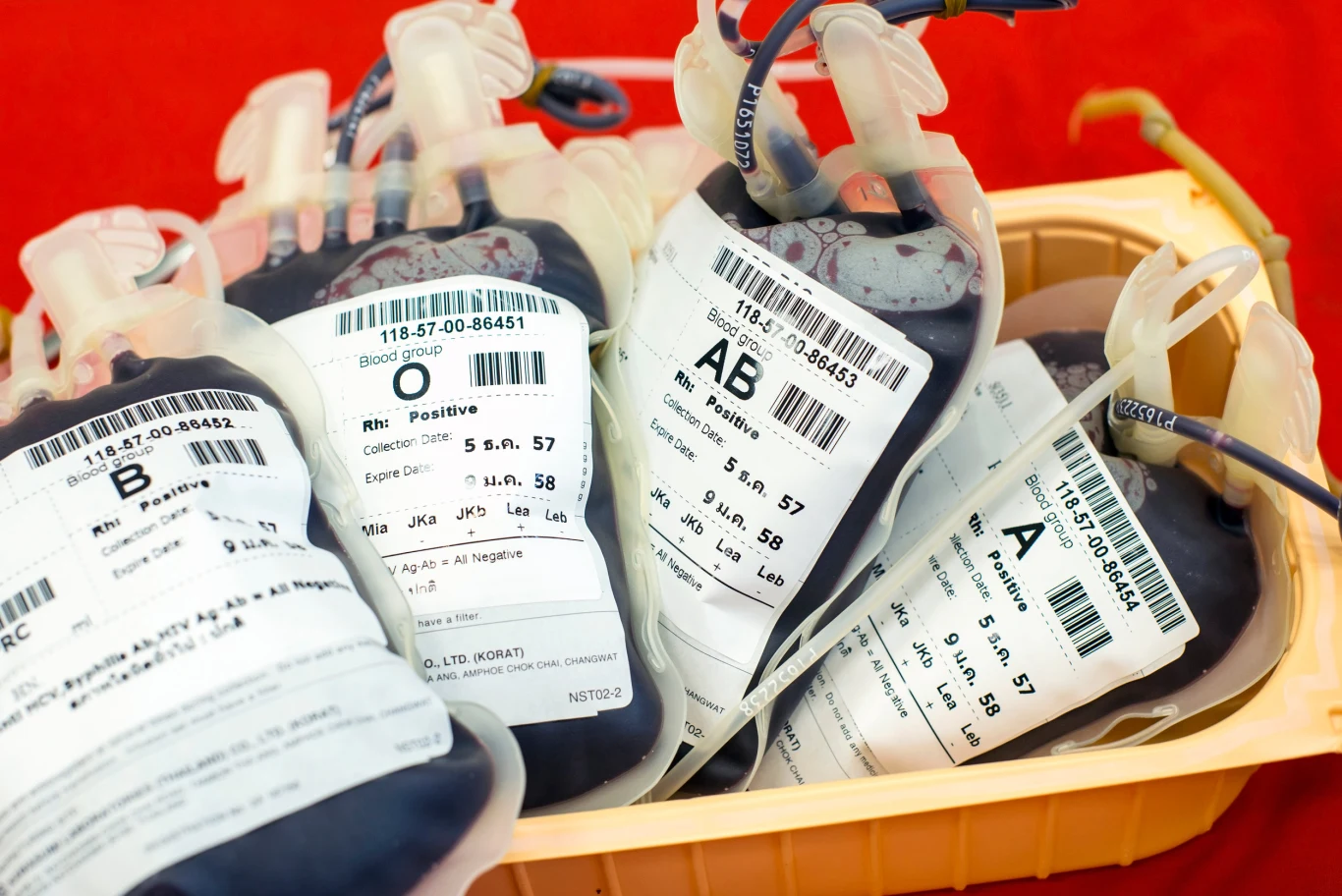 Według twórcy diety zgodnej z grupą krwi, posiadacze grupy A mają tendencję do częstych infekcji a ich organizm dużo słabiej radzi sobie również z chorobami nowotworowymi