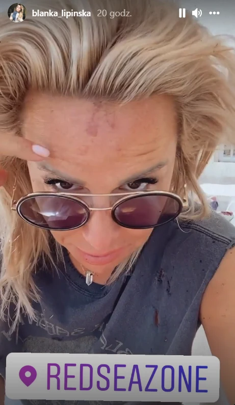 Blanka Lipińska miała wypadek https://www.instagram.com/blanka_lipinska/ Blanka Lipińska miała wypadek https://www.instagram.com/blanka_lipinska/