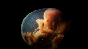 (Zdjęcie poglądowe zdrowego płodu) Trisomię 13. chromosomu lekarze zwykle diagnozują już w 12 tygodniu ciąży. Płód ma tzw. wielowodzie - czyli letalne uszkodzenia większości narządów