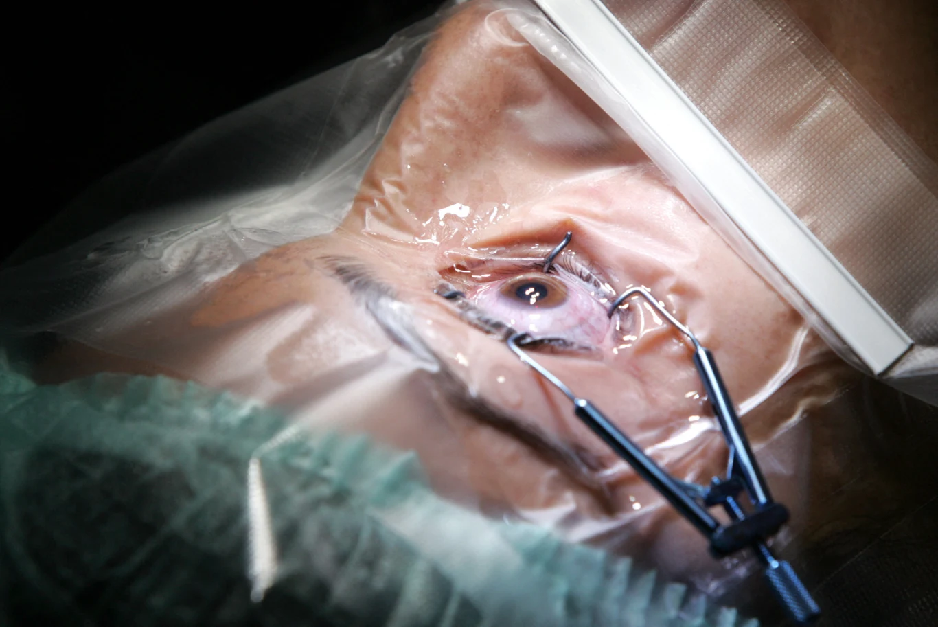 Odkryto nowy rodzaj neuronów budujących siatkówkę oka Odkryto nowy rodzaj neuronów budujących siatkówkę oka