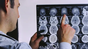 Układ współczulny i przywspółczulny zawiadują m.in. sercem, oddechem i trawieniem. Gdy są zaburzone, skutki odczuwa całe ciało