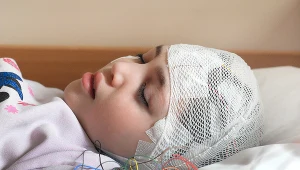 Badania obrazowe głowy są bardzo pomocne w procesie diagnozowania