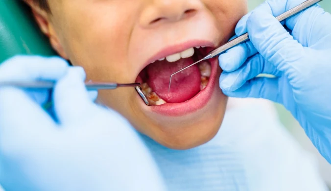 Koniec z borowaniem? Opracowali żel, który naprawia zęby