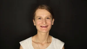 Lata zaniedbań w higienie zębów sprawiły, że trzydziestolatka prawie straciła uzębienie