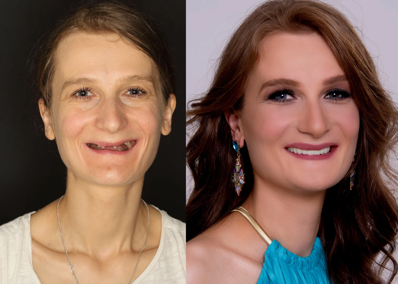 Efekt metamorfozy wykonanej przez Dr Emmę jest powalający! Aż trudno uwierzyć, że to ta sama kobieta