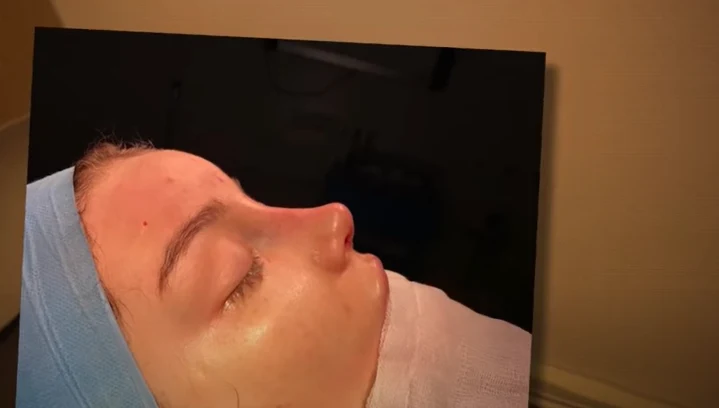 Nowy nos Marcysi @Marcysia Ryskala