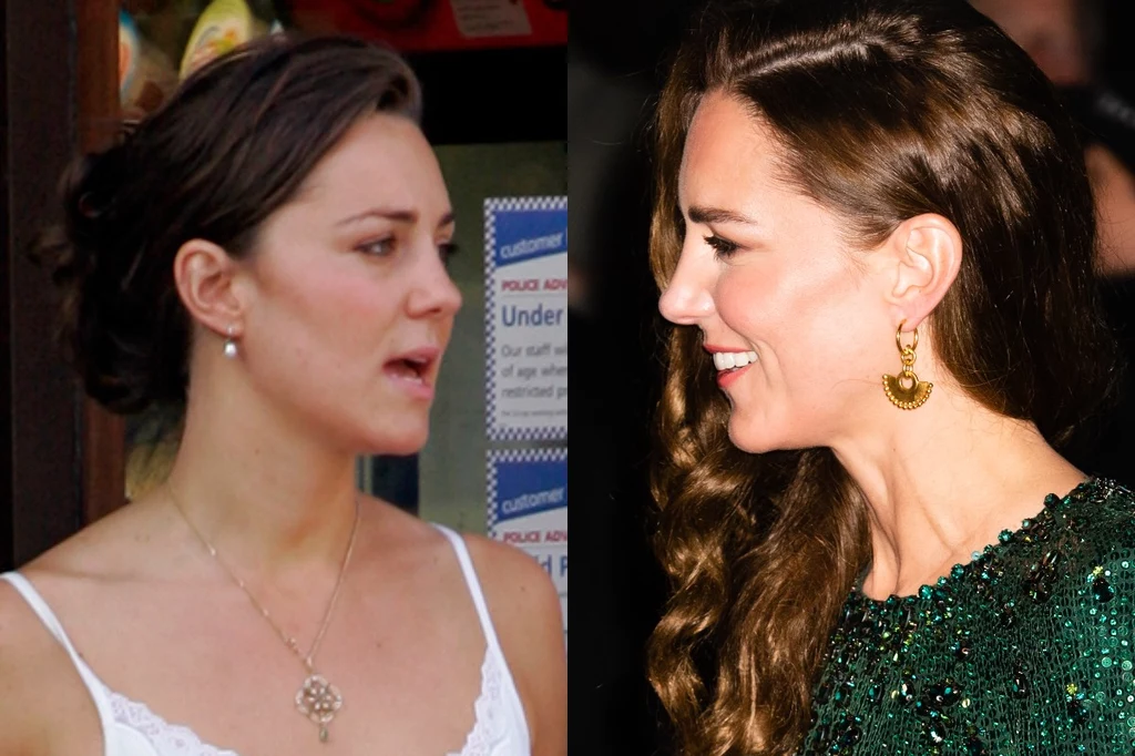 Niektórzy uważają, że twarz Kate zmieniła się na przestrzeni lat