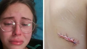 Poszkodowana pielęgniarka