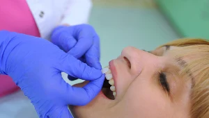 Licówka przykrywa niedoskonałości zębów, nadając im wymarzony wygląd