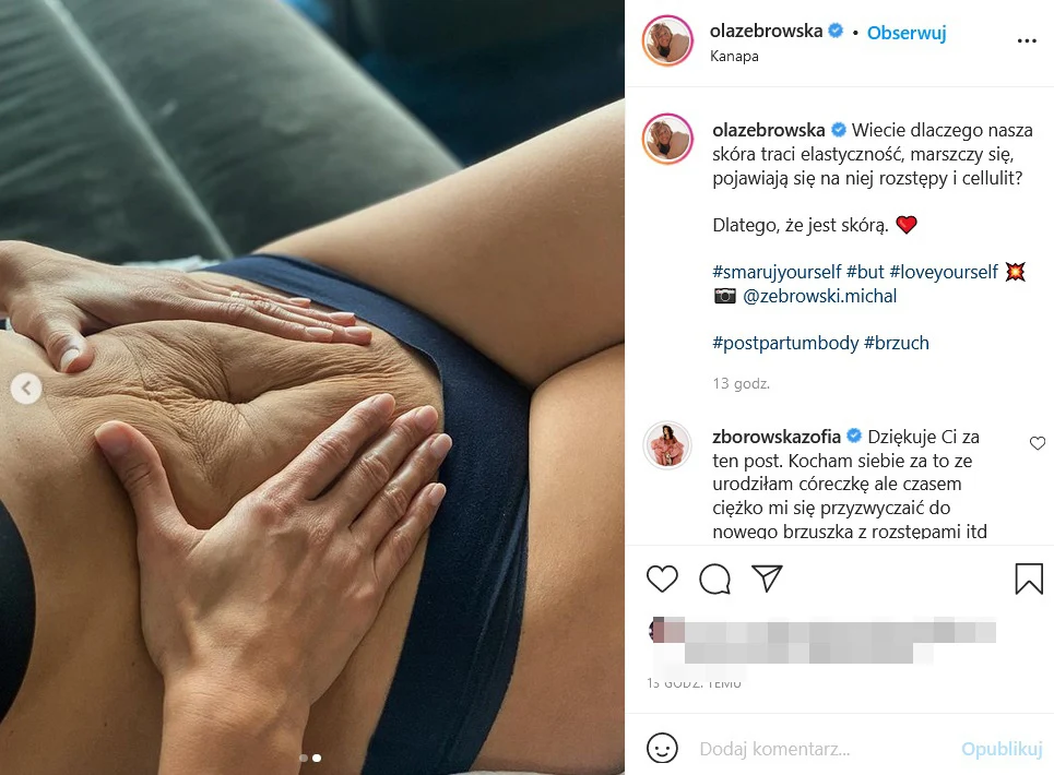 Ola Żebrowska pokazała zdjęcie pomarszczonego brzucha Ola Żebrowska pokazała zdjęcie pomarszczonego brzucha