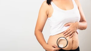 Ciążowe ciało: Od idealizacji i kompleksów po akceptację