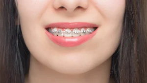 Zastanawiasz się nad aparatem? To trzeba wiedzieć