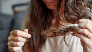 Masz suche i zniszczone włosy? Te 2 produkty z kuchni szybko je uratują 