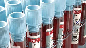 Badanie na obecność wirusa HIV należy wykonać minimum po 2-3 tygodniach od domniemanego momentu zakażenia