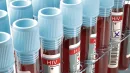 Rekordowa liczba zakażeń HIV w Polsce. Czy grozi nam epidemia?