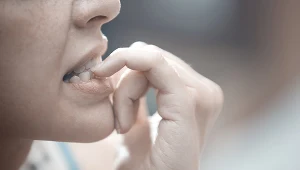 Nie obgryzaj paznokci - ten z pozoru błahy nawyk nie jest obojętny dla zębów 