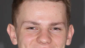 Młody zawodnik MMA stracił zęba podczas treningu. Czy Dr Emma pomoże mu odzyskać piękny uśmiech?