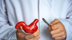 Operacja bariatryczna to ostateczny krok w walce z otyłością