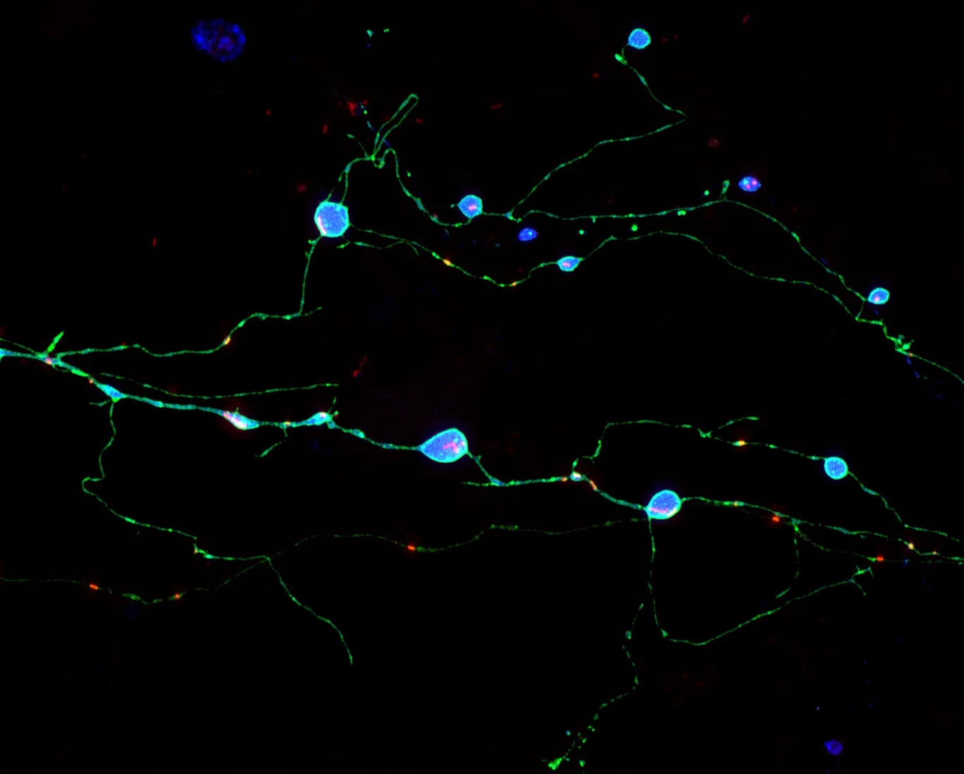 Agregaty prionów (niebieski) tworzące się w aksonach