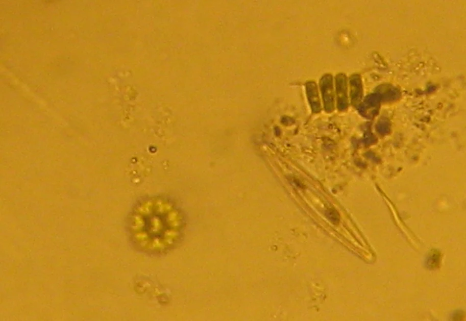 Fitoplankton jeziorny (zdjęcie ilustracyjne). Fitoplankton jeziorny (zdjęcie ilustracyjne).