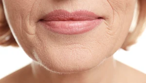 Moment starzenia się tej części twarzy to zdaniem lekarzy czas, gdy "trójkąt młodości" zastępuje "piramida starości" 