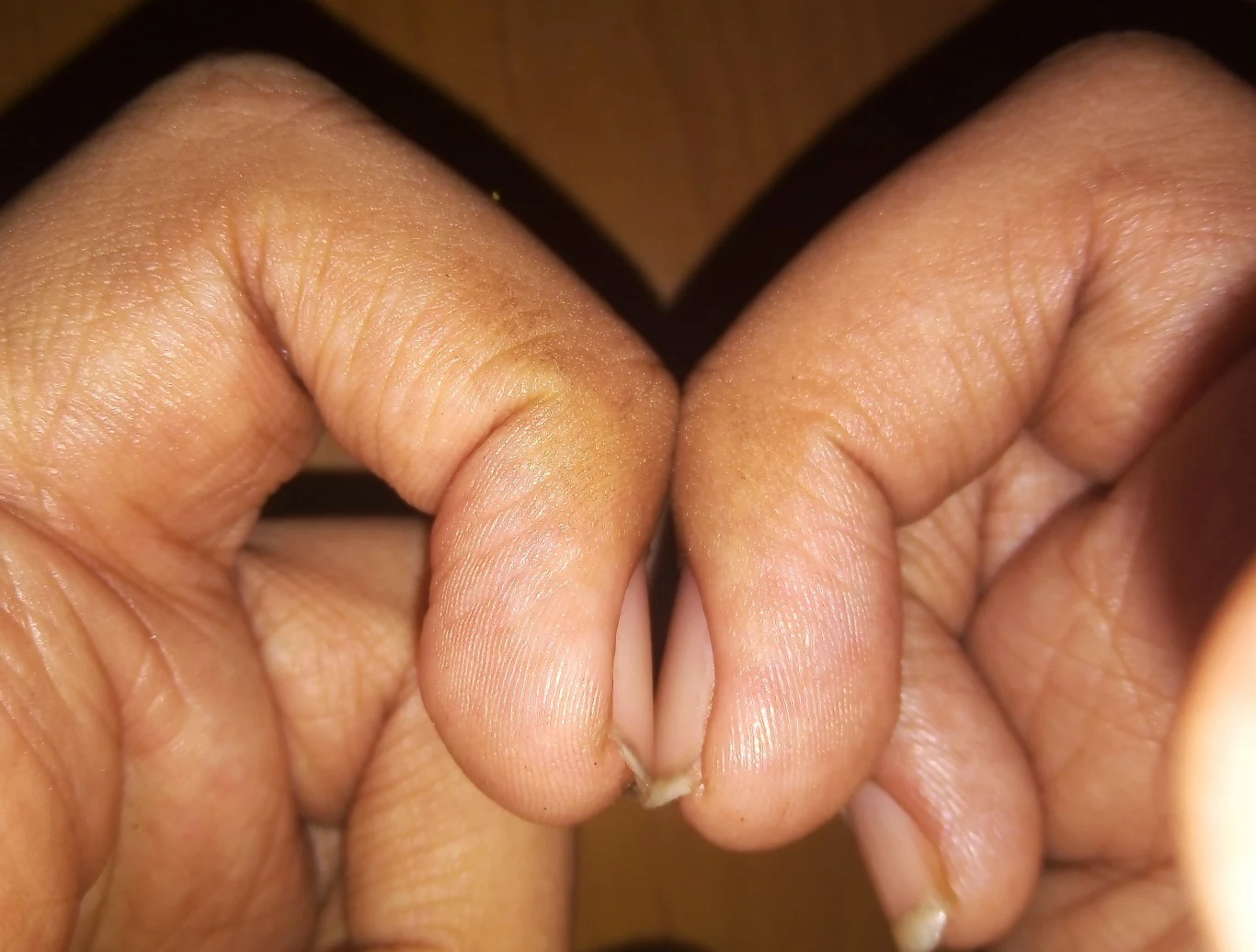 Pomiędzy paznokciami powinna utworzyć się wolna przestrzeń w kształcie rombu