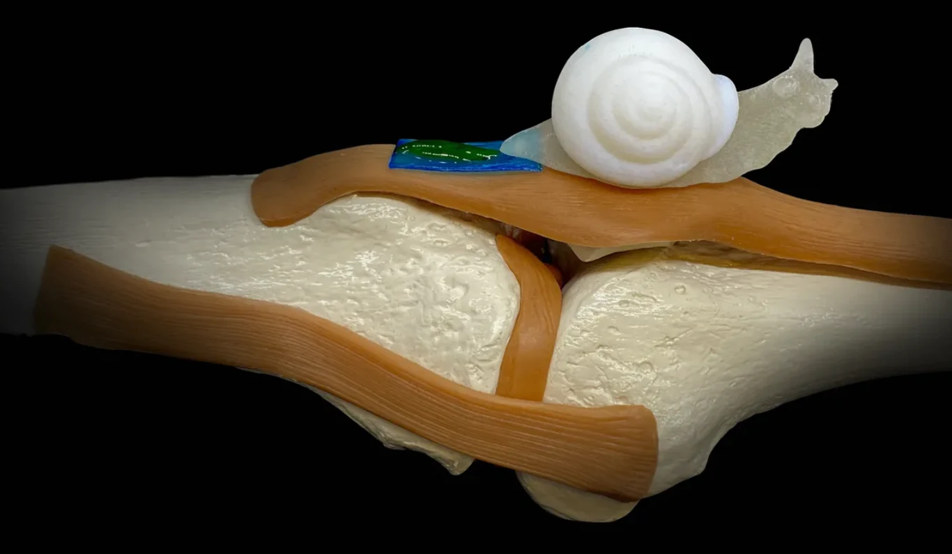 Przełom w regeneracji ścięgien - pomoże nowy biomateriał Przełom w regeneracji ścięgien - pomoże nowy biomateriał