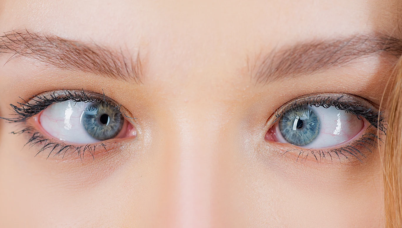 Czy zezowanie zostaje na zawsze? Czy zezowanie zostaje na zawsze?