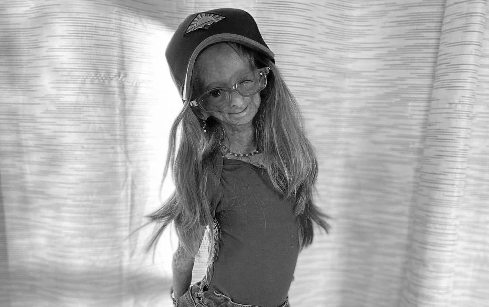 Adalia Rose Williams