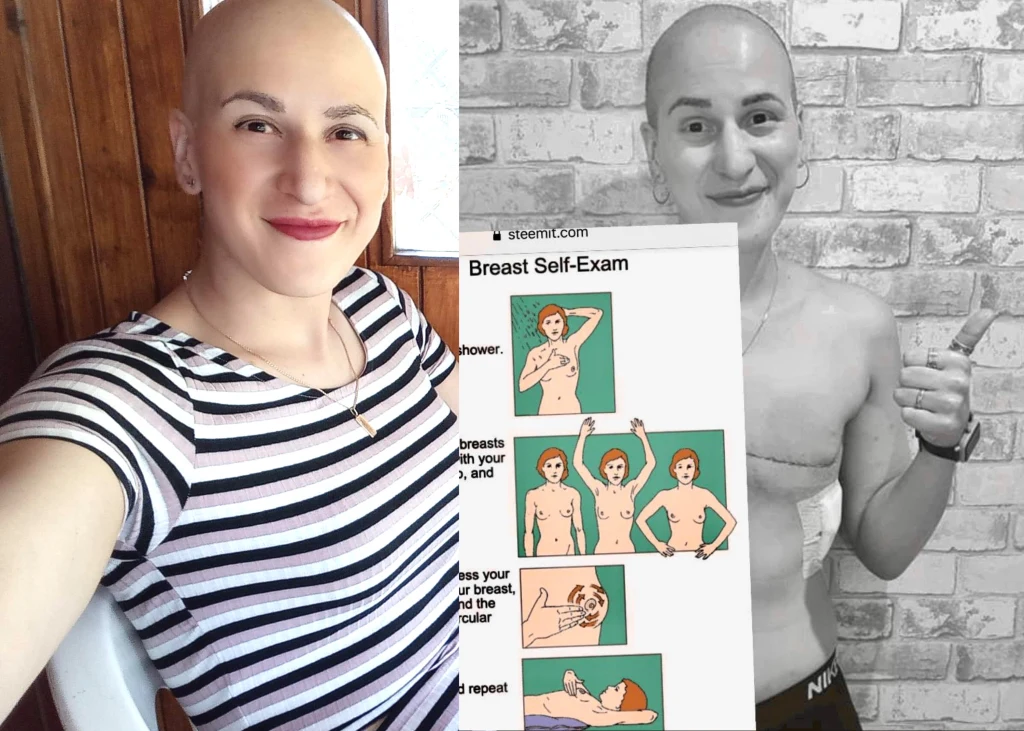 - Byłam jedyną łysą pacjentką na całym oddziale onkologii. Już nie wstydzę się choroby. Wy też nie musicie - przekonuje Fatima - Byłam jedyną łysą pacjentką na całym oddziale onkologii. Już nie wstydzę się choroby. Wy też nie musicie - przekonuje Fatima