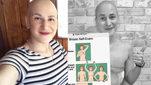 - Byłam jedyną łysą pacjentką na całym oddziale onkologii. Już nie wstydzę się choroby. Wy też nie musicie - przekonuje Fatima