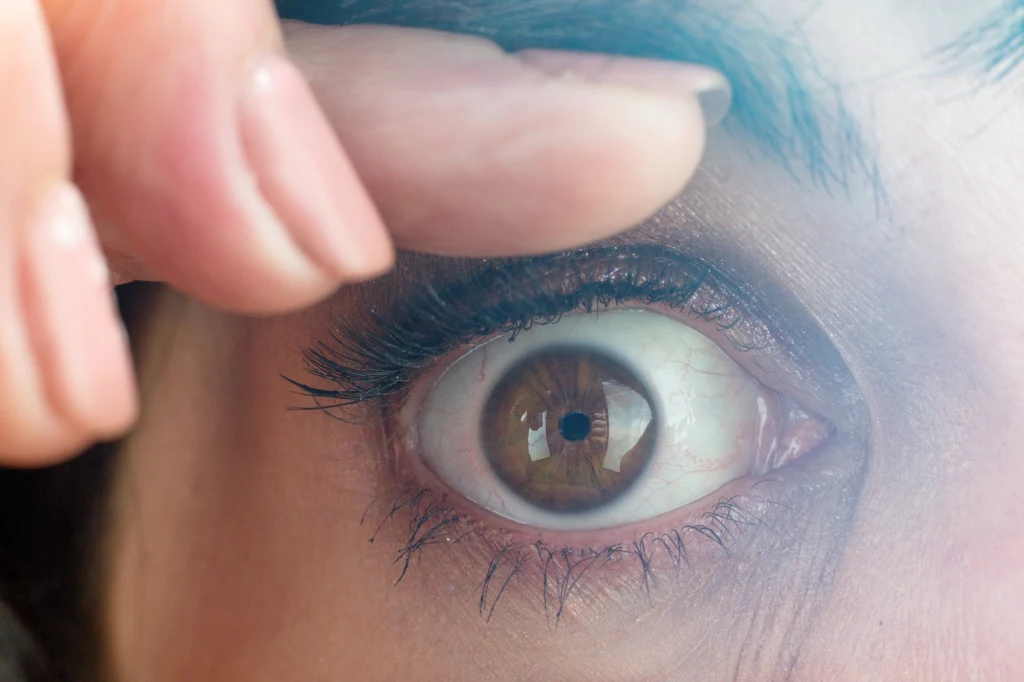 Oczopląs objawia się w dość charakterystyczny sposób. Wyjaśniamy, co może za tym stać