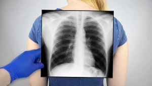 Kaszel u dziecka. Czy zawsze jest objawem infekcji?