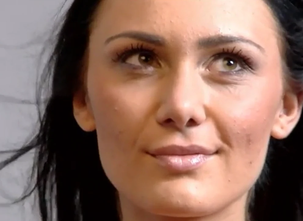 Jessica Ziólek przed operacją nosa w programie "Sekrety chirurgii" Zrzut ekranu z odcinka "Chcę być marzeniem mężczyzn" Jessica Ziólek przed operacją nosa w programie "Sekrety chirurgii" Zrzut ekranu z odcinka "Chcę być marzeniem mężczyzn"