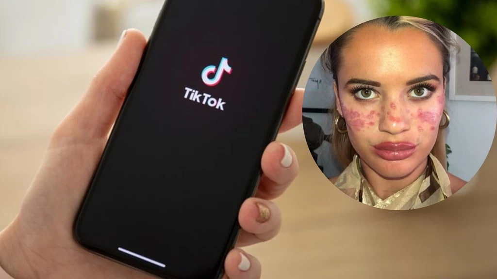 21-latka wykonała jeden z trendów urodowych z TikToka. Zakończyło się wizytą w szpitalu (Instagram)